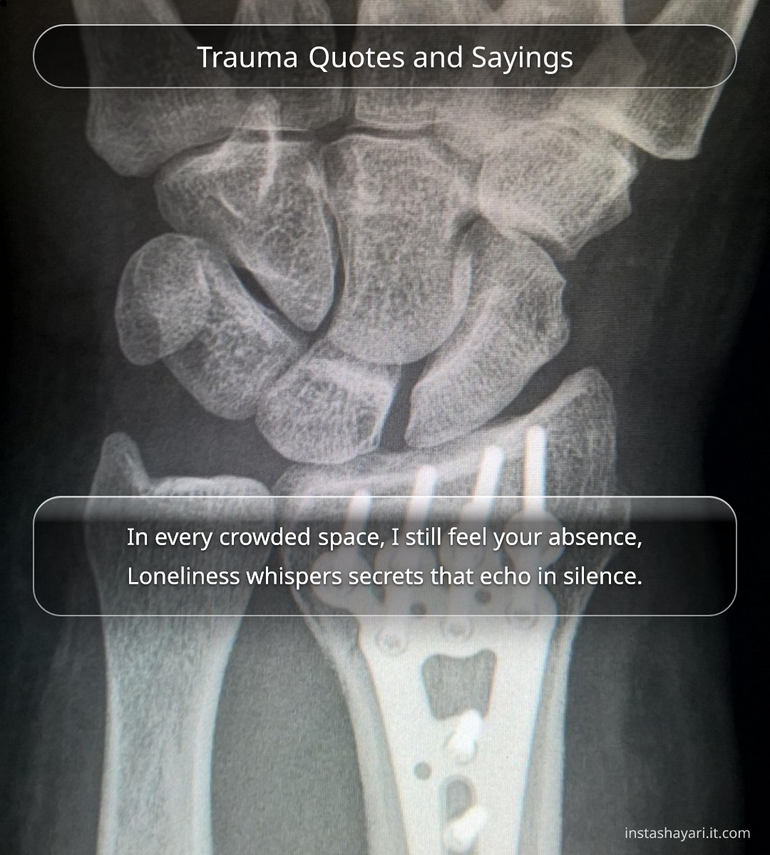 Trauma Quotes and Sayings